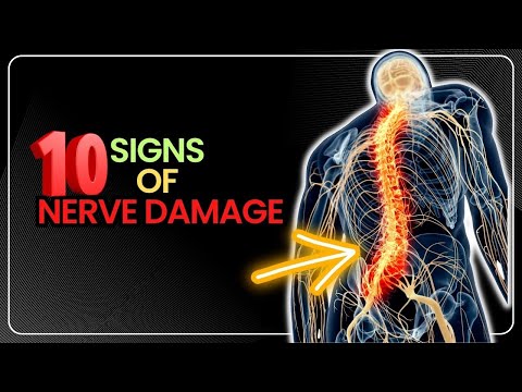 10 Symptoms and Signs of Nerve Damage You Should Never Ignore