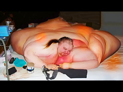 Remember The World’s Most Obese Woman? This Is What Happened To Her!